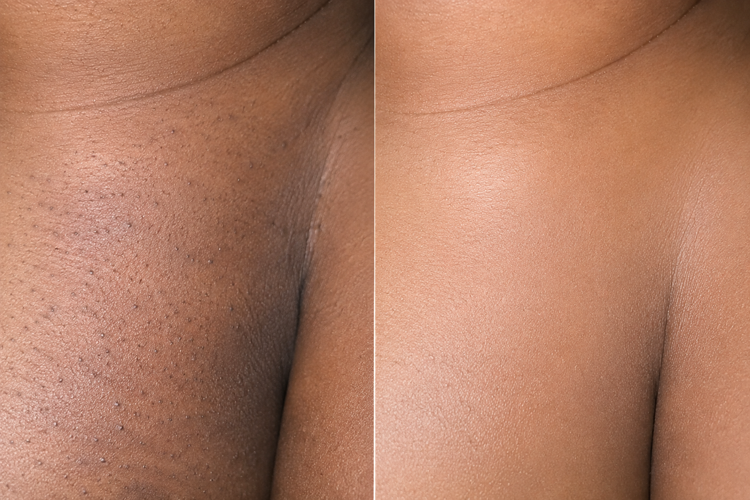Before and after using Kitty Potion pineapple yoni oil
